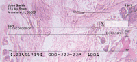 Breast Carcinoma Checks