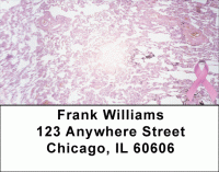 Click on Breast Carcinoma Address Labels For More Details